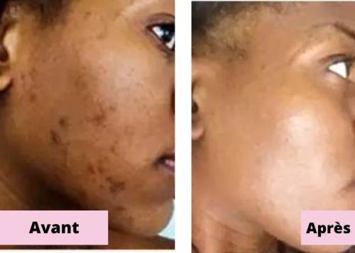 Black Soap with Bamboo Charcoal