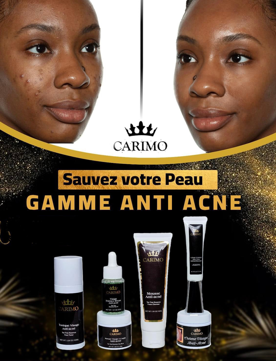 GAMME ANTI-ACNE